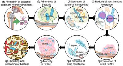 Recent Progress in antibacterial hydrogel coatings for targeting biofilm to prevent orthopedic implant-associated infections